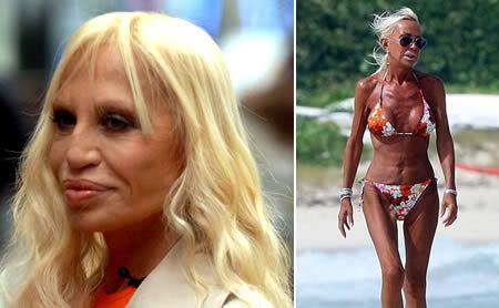 donatella versace before surgery. Donatella Versace: a